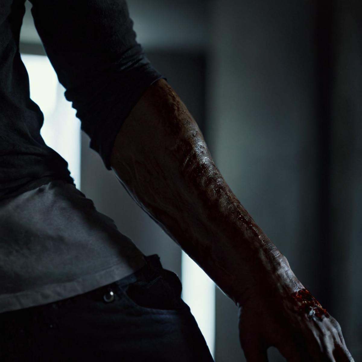 Horror-themed,  1 realism perfect Chiaroscuro Lighting Style A different unique picture of a person with a wound in their...